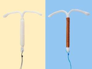 What’s an IUD?
